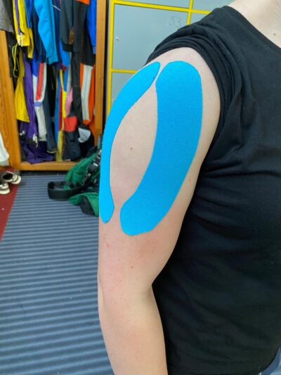 Alisa shoulder injury